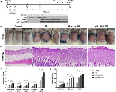 Pregnane X receptor reduces particulate matter-induced type 17 inflammation in atopic dermatitis